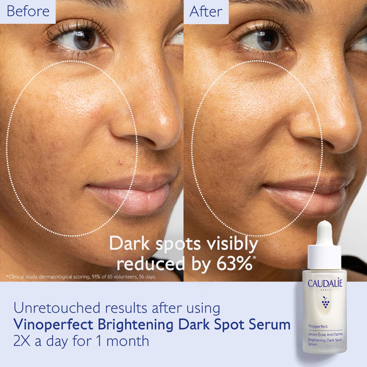 Vinoperfect Brightening Dark Spot Serum Vitamin C Alternative *PRE-ORDER*