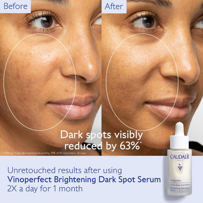 Vinoperfect Brightening Dark Spot Serum Vitamin C Alternative *PRE-ORDER*