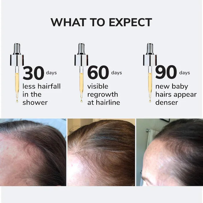 Youth Juice Collagen Scalp Serum for Thinning Hair * PRE-ORDER*
